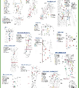 פוסטר של מיקומי נקודות trigger points למטפלים