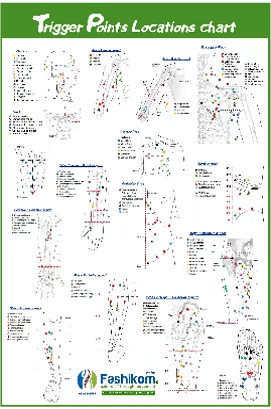 פוסטר של מיקומי נקודות trigger points למטפלים